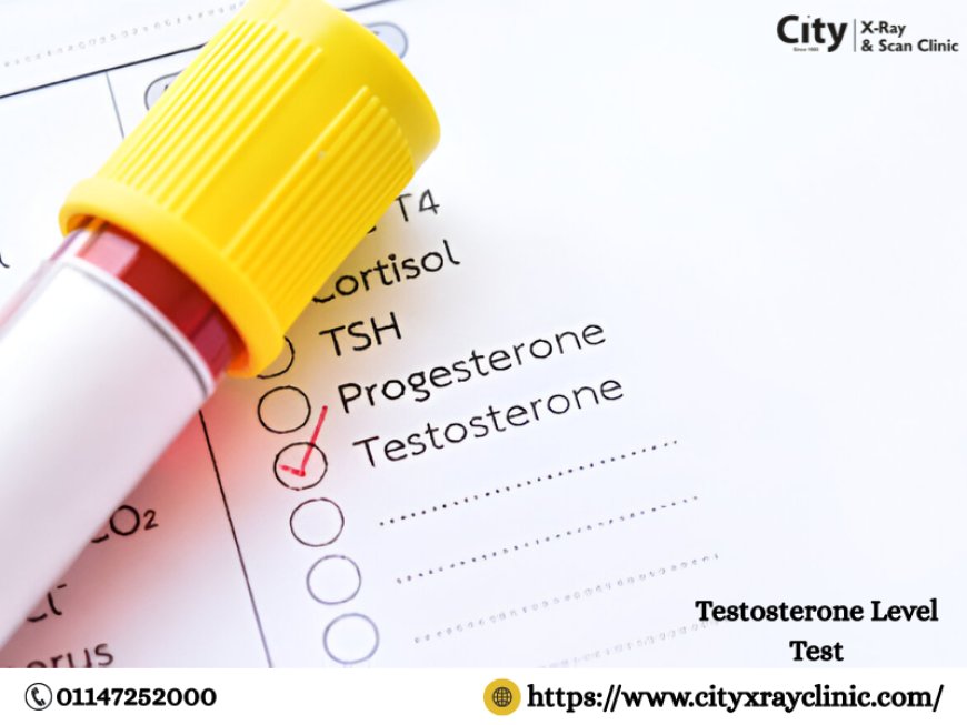 Testosterone Test Price Delhi: Know What You’ll Pay and Why It Matters